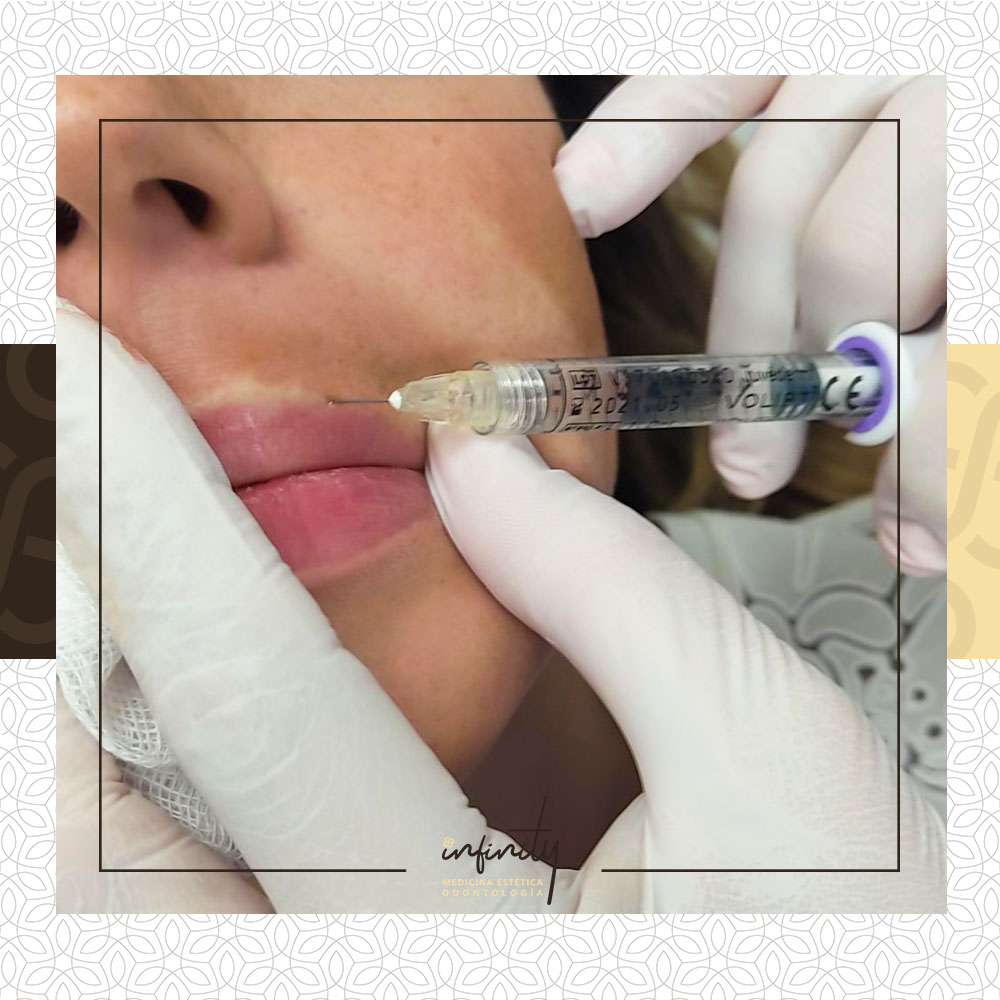 ácido hialurónico Clínicas Infinity Jaén24h