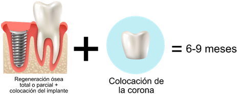 Odontologia jaen cleardent dental jaen24h